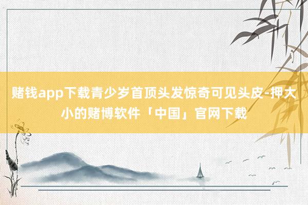赌钱app下载青少岁首顶头发惊奇可见头皮-押大小的赌博软件「中国」官网下载